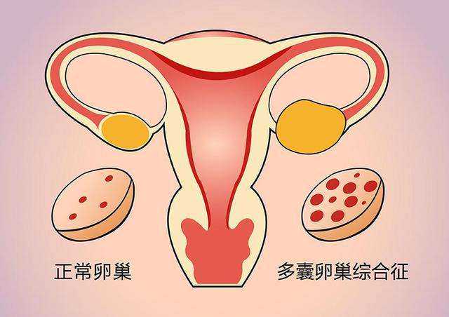 太原在哪捐卵子 太原试管婴儿医院推荐 ‘6个月b超图怎么分辨是男是女’