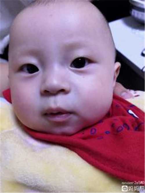 绍兴代孕产子机构 2022在绍兴市妇幼保健院做供卵试管婴儿要多少钱? ‘b超下男孩和女孩的区别图’